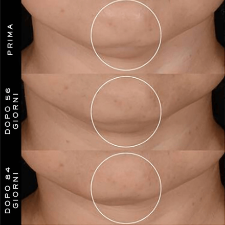 Rénergie H.P.N. 300-peptide Cream 50ml Tester - Lancôme